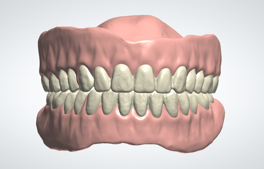 Copy Denture